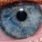 ojo seco tratamiento 1 85x85