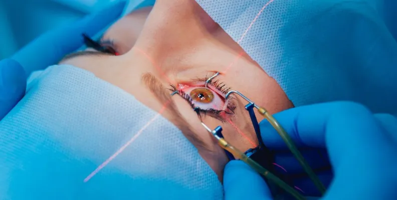 Primer plano del ojo de un paciente durante la intervención con láser LASIK en la clínica de León, utilizando un espéculo palpebral