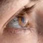 Vista lateral de un ojo humano con cornea puntiaguda para saber que es queratocono y como se corrige 85x85