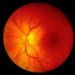 Examen de fondo de ojo con senales claras de salud ocular para prevenir la retinopatia diabetica real 85x85