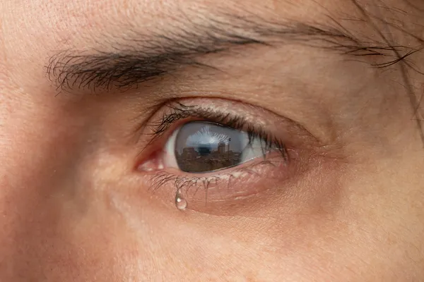 Detalle de un ojo femenino lloroso que intenta compensar la falta de lubricación natural del ojo seco intenso